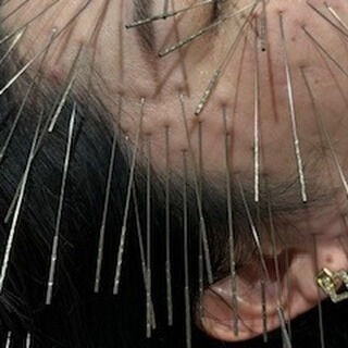 患者様からのご感想