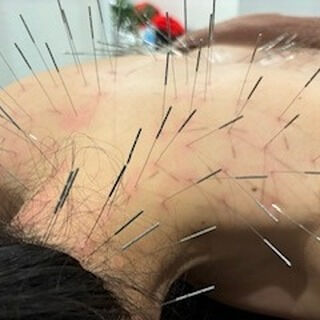 寒くなってきたこともあり首肩こりの方が多くなってきました