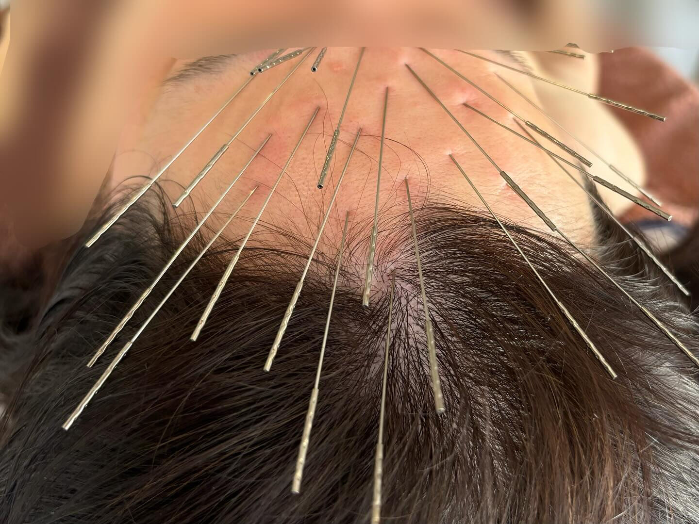 不眠、不安、気分の浮き沈みなど心身の不調に悩まされている方が