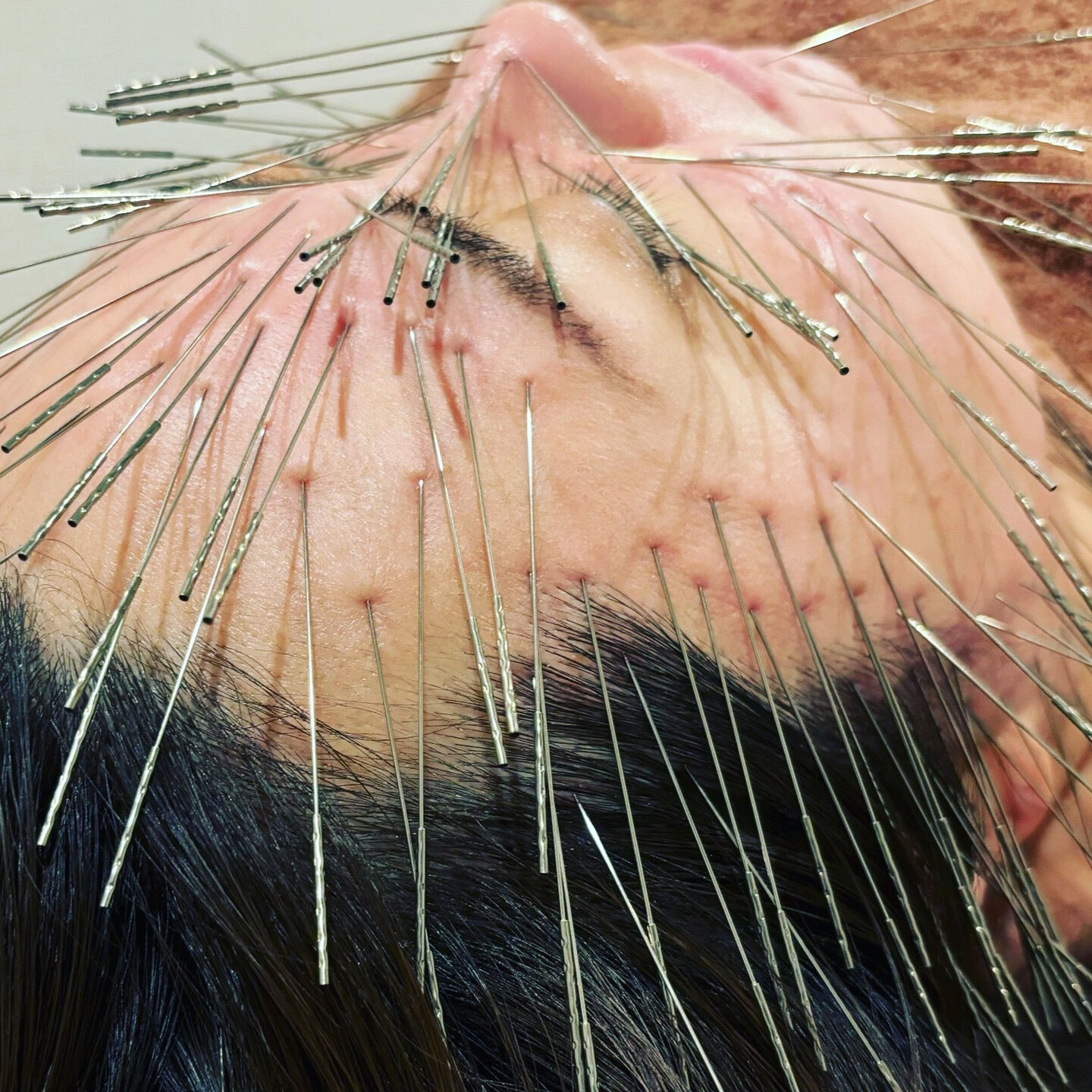 腰の硬さや痛み、頭部や顔のむくみ、眼精疲労、そして脳疲労