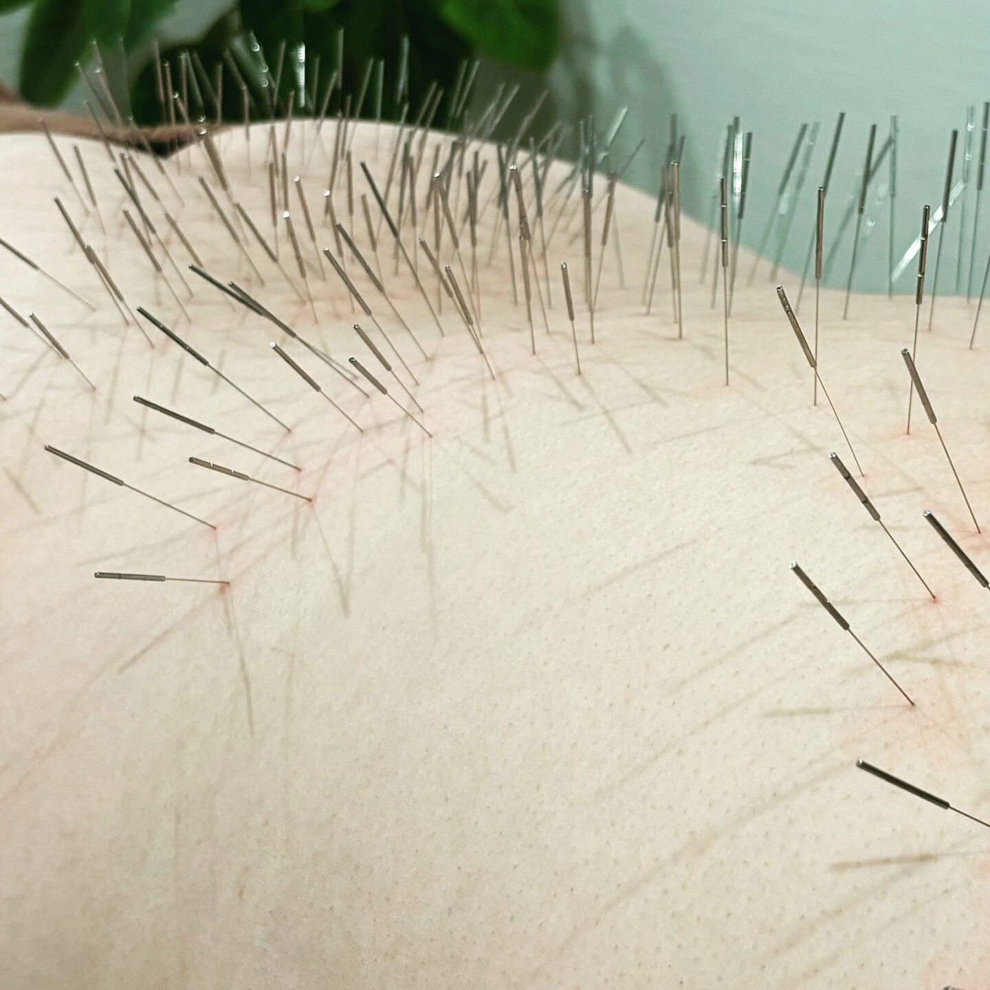 腰の硬さや痛み、頭部や顔のむくみ、眼精疲労、そして脳疲労