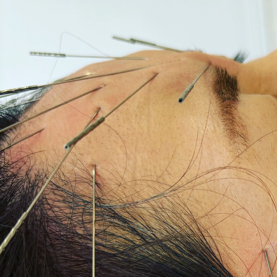首コリや肩こり、腰痛にお悩みの方にとって、毎日の生活が辛くな