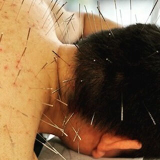 本日ご来院された患者様は、毎晩遅くまでの勤務により疲労が蓄積