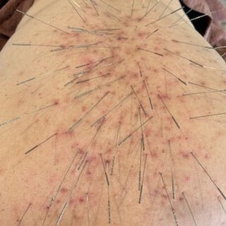 本日ご来院された患者様は、毎晩遅くまでの勤務により疲労が蓄積