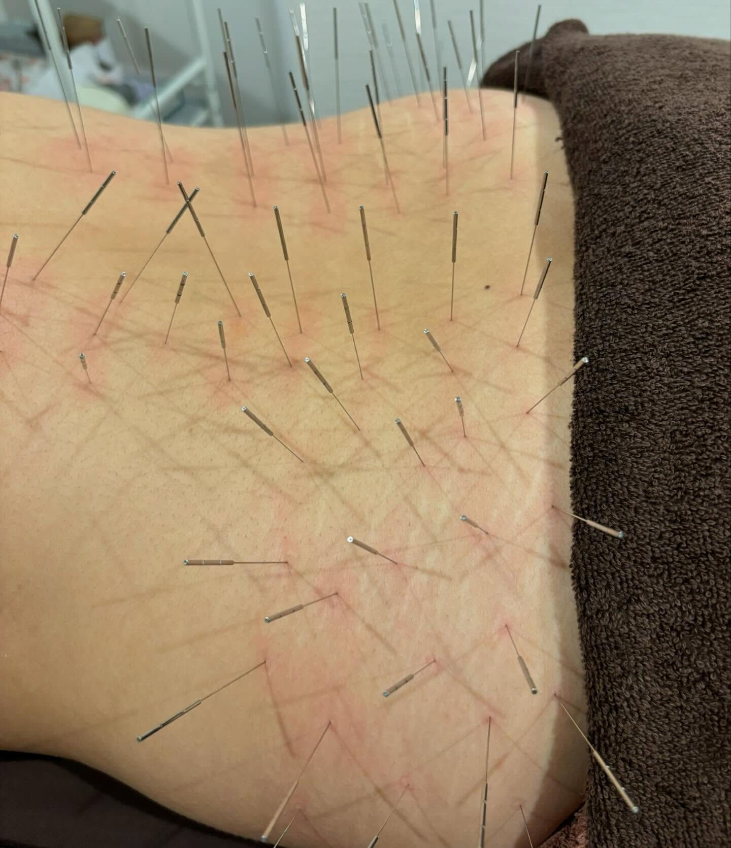 先日、同じ鍼灸師である了戒さんが、