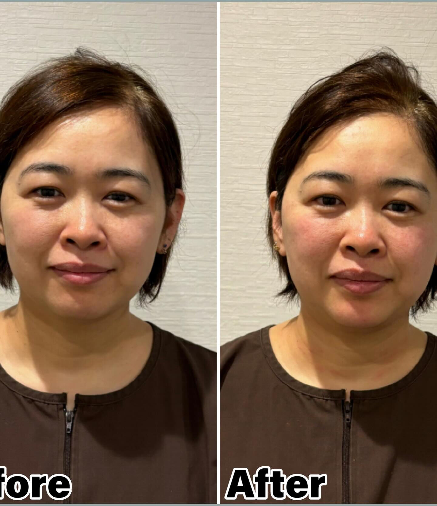 先日、同じ鍼灸師である了戒さんが、