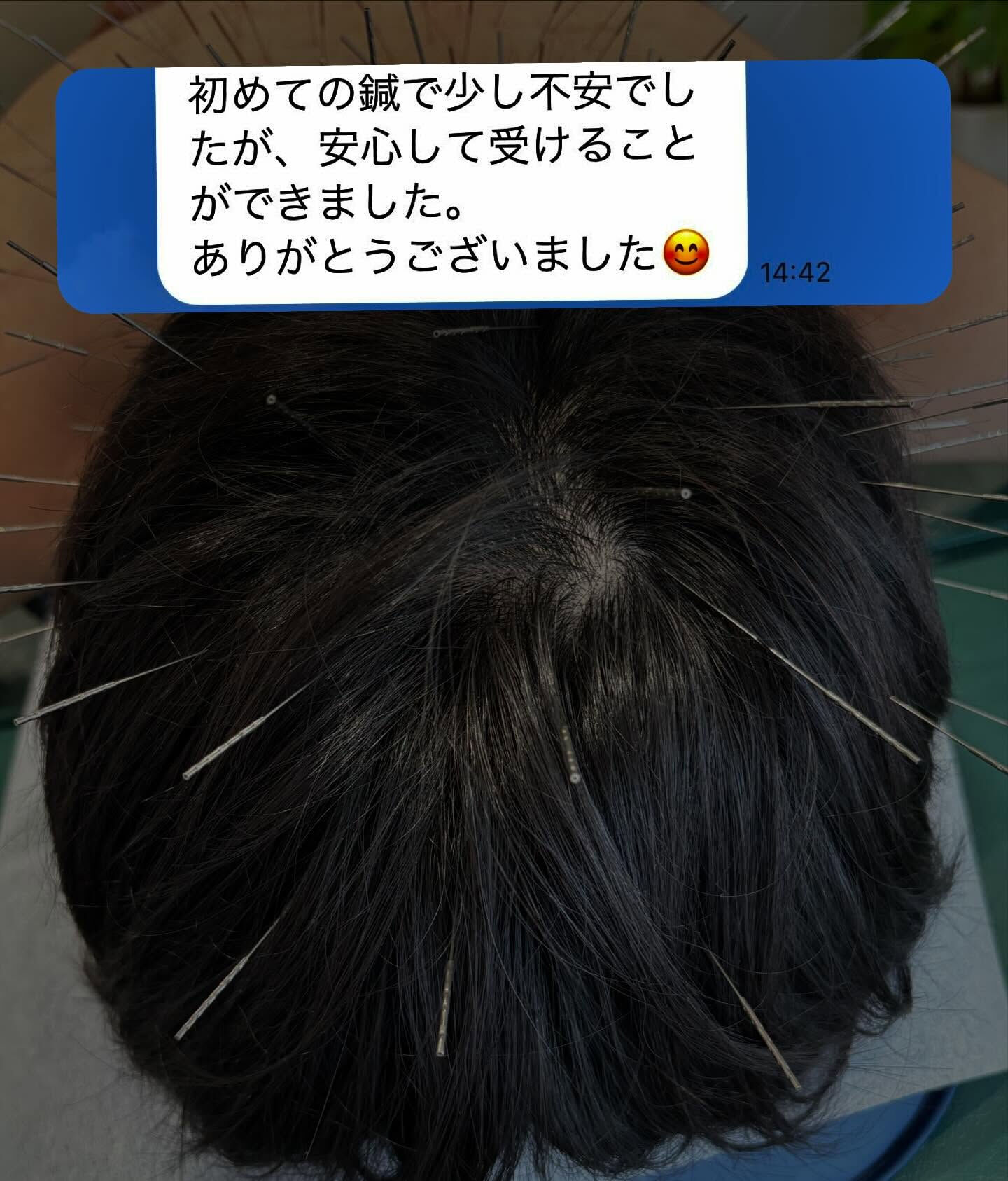 本日は、初めて鍼治療を受けられる患者さんがご来院くださいまし