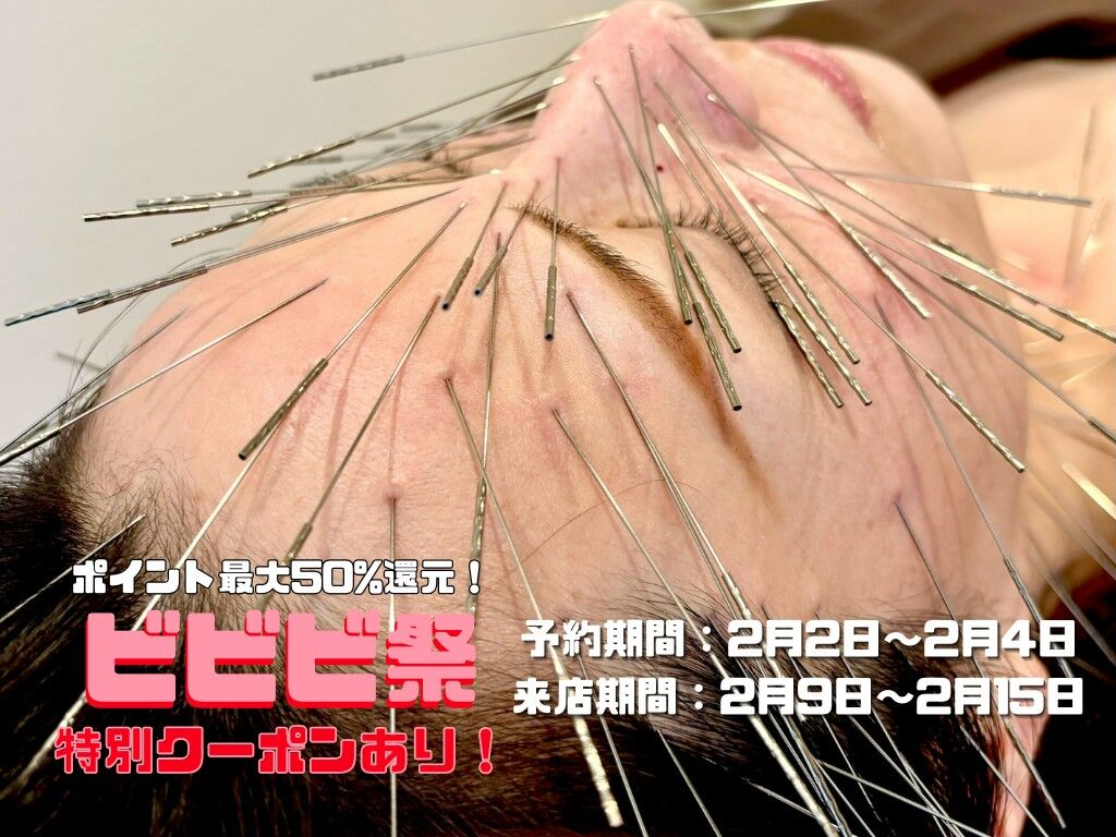 ホットペッパービューティーのビビビ祭は＜鍼日和＞も対象です！ 