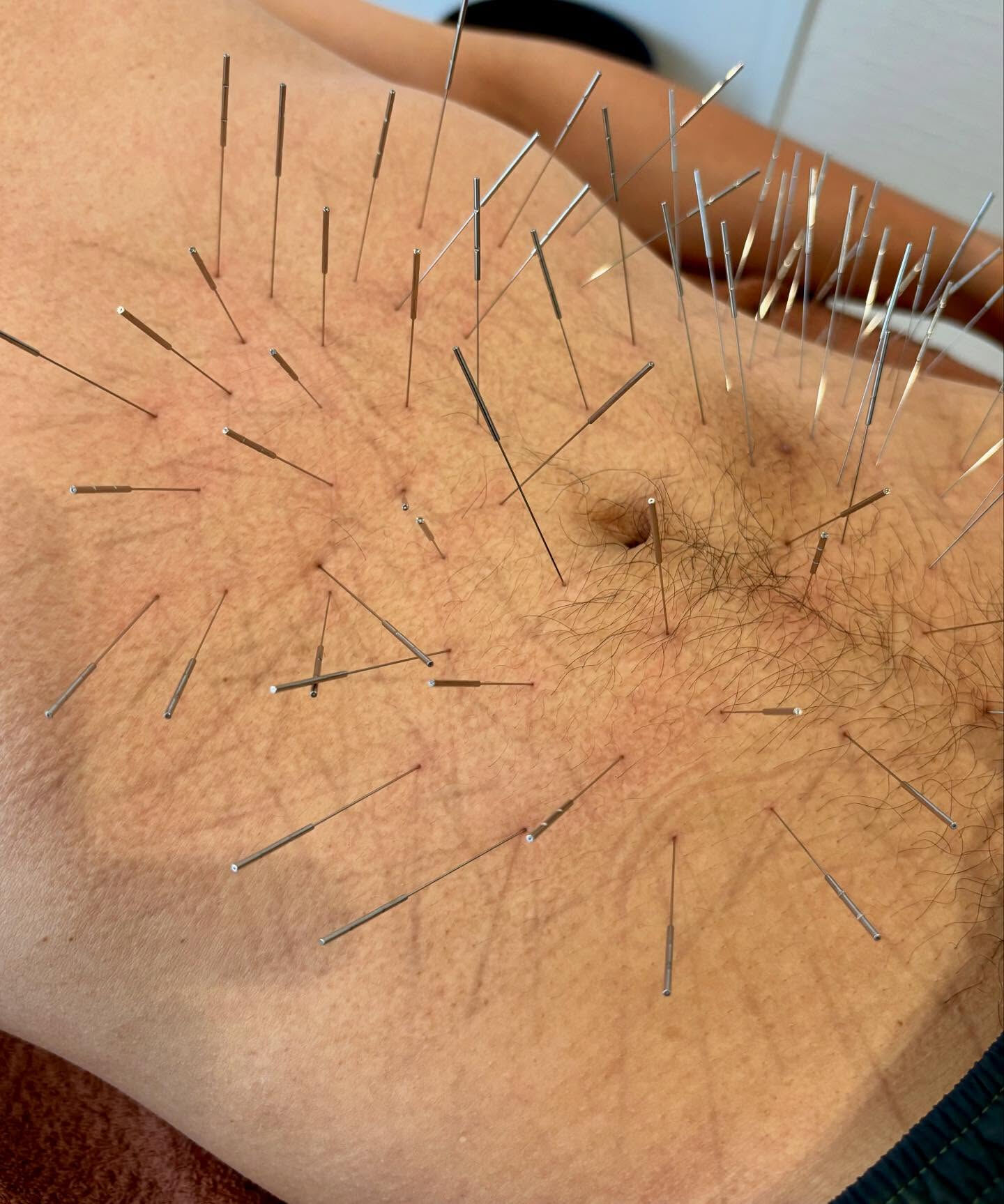 日々の生活の中で、自覚症状がないまま蓄積されていくコリに悩ん