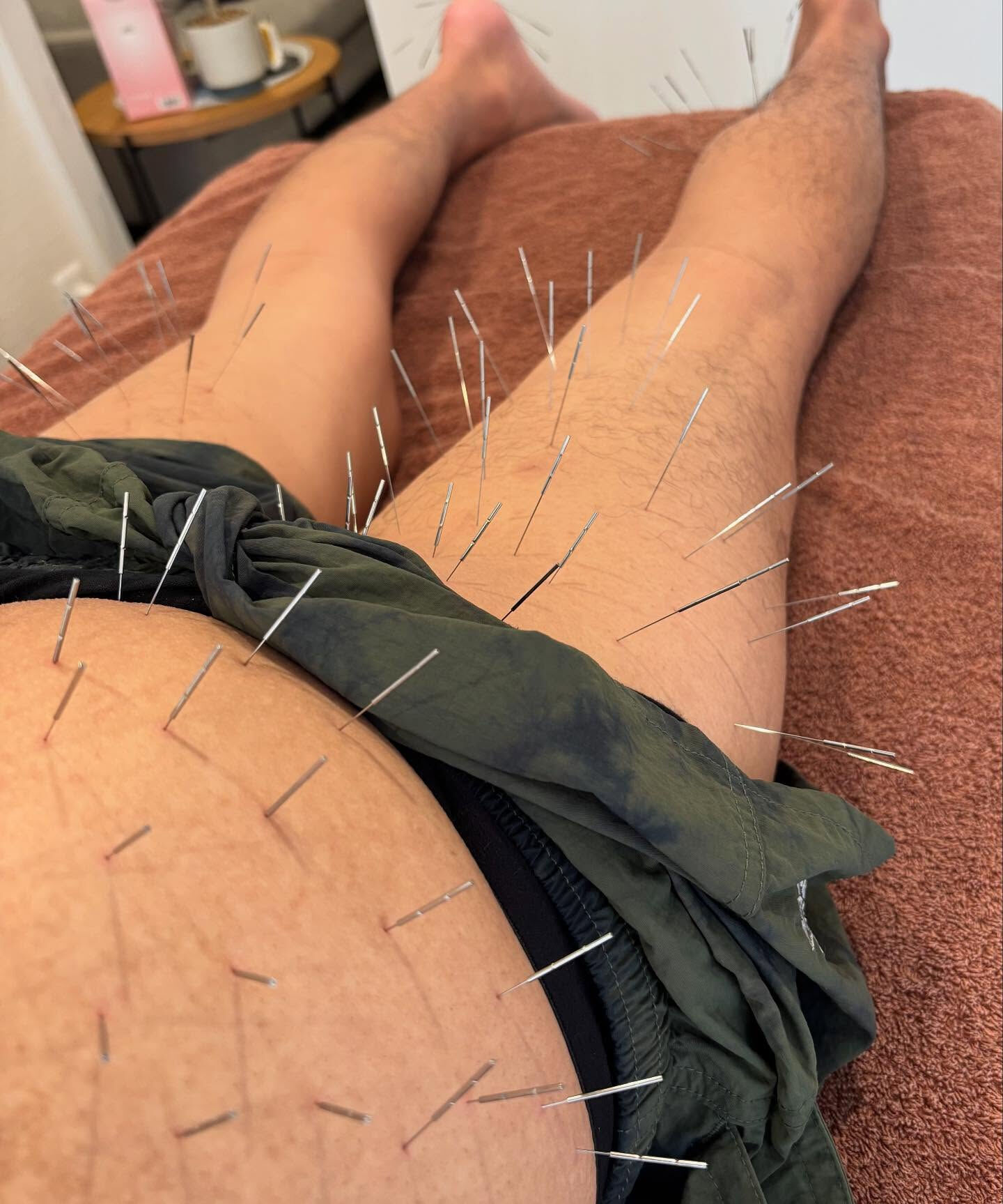 日々の生活の中で、自覚症状がないまま蓄積されていくコリに悩ん
