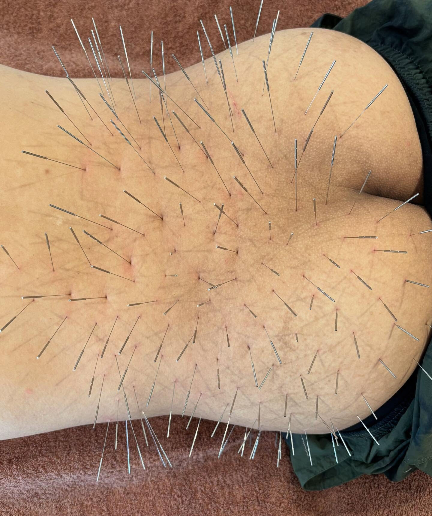 日々の生活の中で、自覚症状がないまま蓄積されていくコリに悩ん