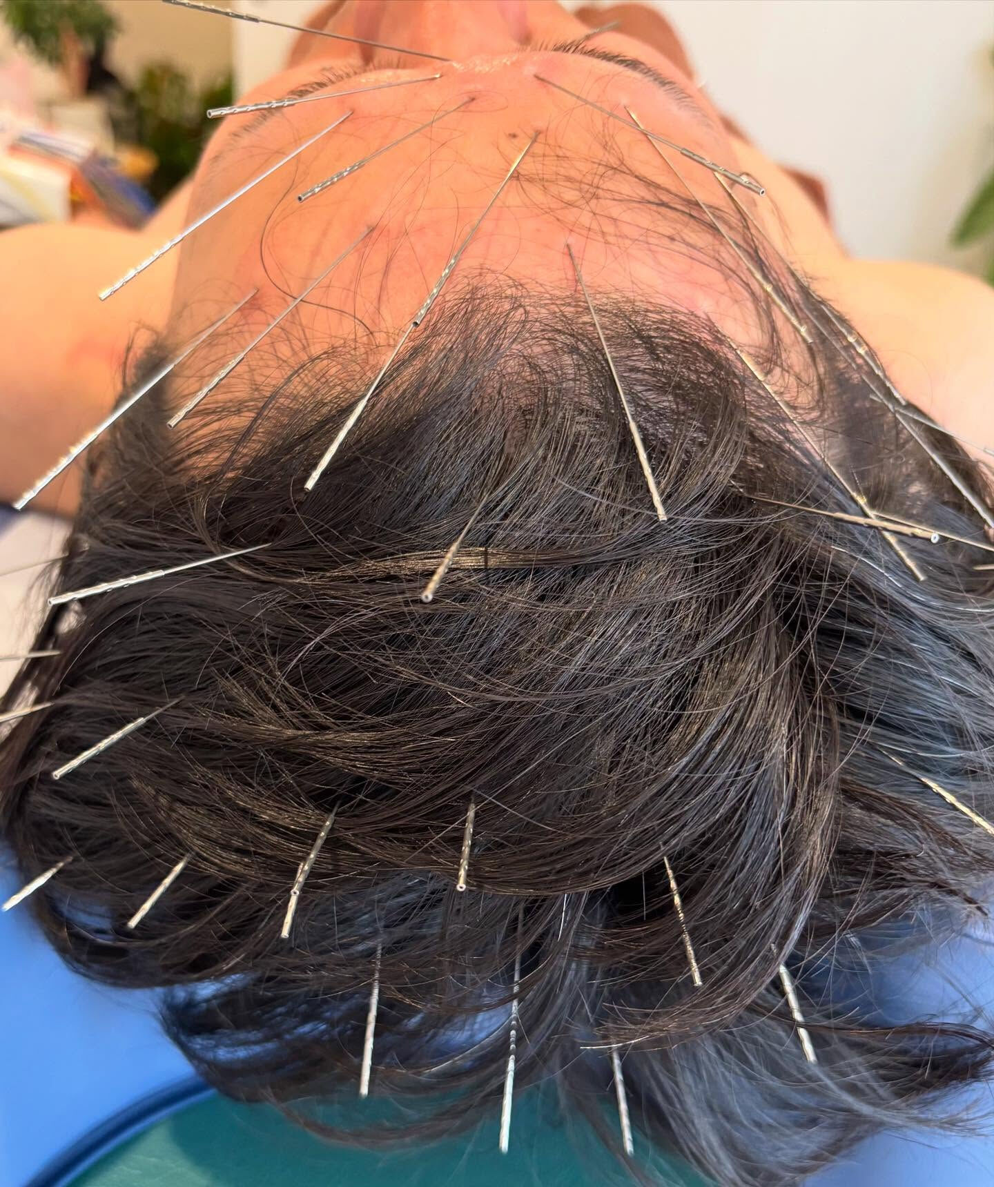 日々の生活の中で、自覚症状がないまま蓄積されていくコリに悩ん