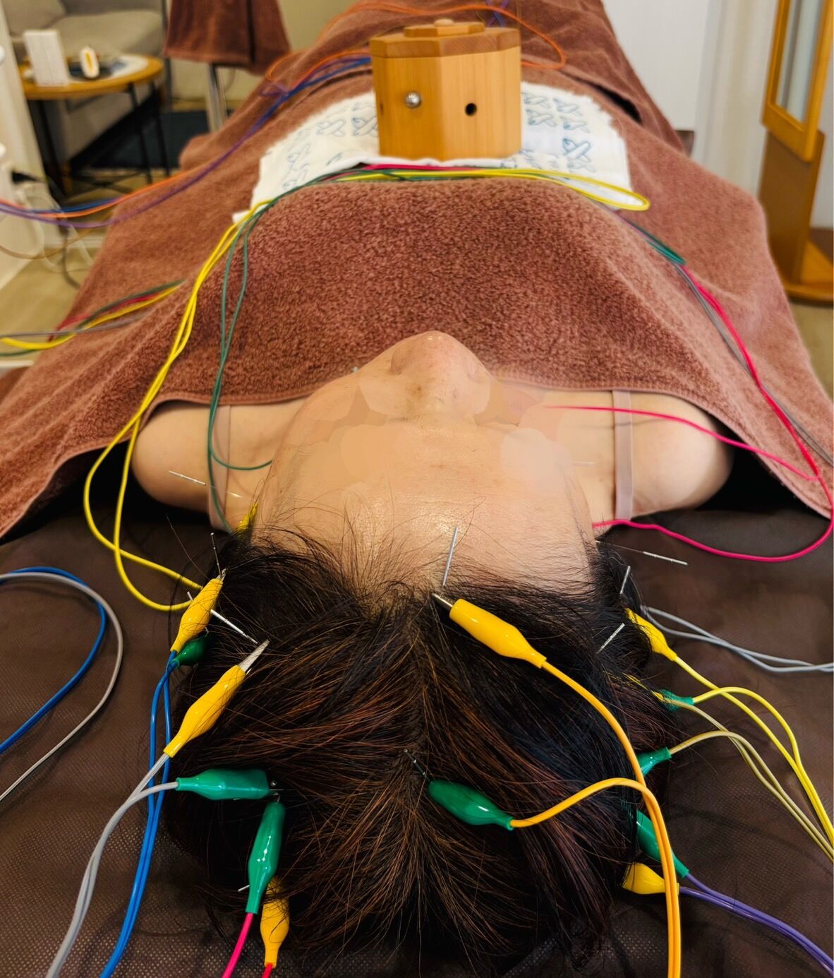 胃腸の不調・重だるさはありませんか？鍼灸で「胃腸の調子を整える」温活ケア  
